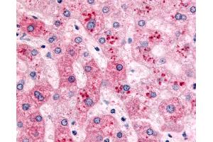 Anti-PYGL antibody IHC of human liver. (PYGL antibody  (C-Term))