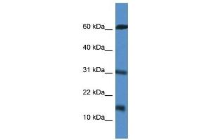 Western Blot showing CARD17 antibody used at a concentration of 1 ug/ml against Jurkat Cell Lysate