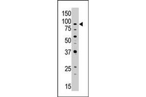 The ABCB7 polyclonal antibody  is used in Western blot to detect ABCB7 in Jurkat cell lysate. (ABCB7 antibody  (C-Term))