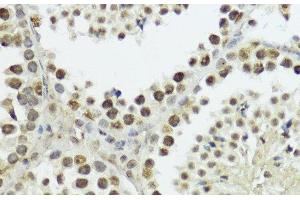 Immunohistochemistry of paraffin-embedded Mouse testis using Phospho-Histone H3(T11) Polyclonal Antibody at dilution of 1:100 (40x lens). (Histone 3 antibody  (pThr11))