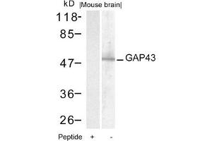 Western blot analysis of extracts from mouse brain tissue using GAP43(Ab-41) Antibody and the same antibody preincubated with blocking peptide.