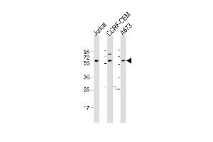 Western Blot at 1:2000 dilution Lane 1: Jurkat whole cell lysate Lane 2: CCRF-CEM whole cell lysate Lane 3: A673 whole cell lysate Lysates/proteins at 20 ug per lane. (CCT8L2 antibody  (AA 92-124))