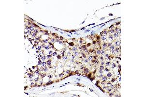 Immunohistochemistry of paraffin-embedded Human testis using S antibody (ABIN7270138) at dilution of 1:200 (40x lens). (SALL4 antibody  (AA 853-1053))