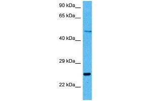 Host:  Mouse  Target Name:  PAX6  Sample Tissue:  Mouse Kidney  Antibody Dilution:  1ug/ml (PAX6 antibody  (N-Term))