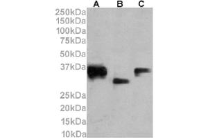 Western Blot using anti-CD74 antibody LN-2. (Recombinant CD74 antibody)