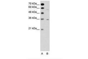 Image no. 1 for anti-G Protein-Coupled Receptor, Family C, Group 5, Member A (GPRC5A) (C-Term) antibody (ABIN6736330) (GPRC5A antibody  (C-Term))