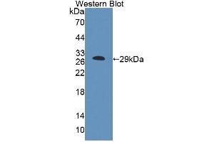 Figure. (ABCF1 antibody  (AA 617-837))