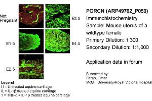Immunohistochemistry (IHC) image for anti-Porcupine Homolog (PORCN) (N-Term) antibody (ABIN503073) (PORCN antibody  (N-Term))