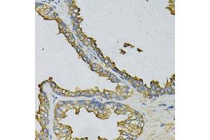 Immunohistochemistry of paraffin-embedded human prostate using RPLP0 Antibody (ABIN6290910) at dilution of 1:100 (40x lens).