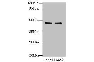 Western blot All lanes: GPR34 antibody at 8 μg/mL Lane 1: Mouse liver tissue Lane 2: Mouse kidney tissue Secondary Goat polyclonal to rabbit IgG at 1/10000 dilution Predicted band size: 44 kDa Observed band size: 44 kDa