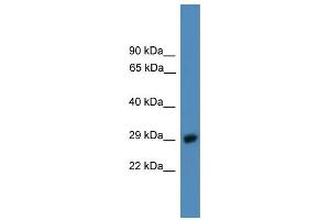 WB Suggested Anti-PSMD9 Antibody Titration: 0. (PSMD9 antibody  (C-Term))