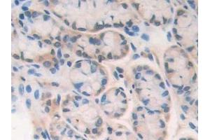Detection of PARP in Mouse Intestine Tissue using Polyclonal Antibody to Poly ADP Ribose Polymerase (PARP) (PARP1 antibody  (AA 661-881))