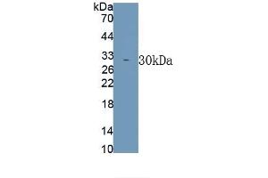 Detection of Recombinant TNFSF12, Rat using Polyclonal Antibody to Tumor Necrosis Factor Ligand Superfamily, Member 12 (TNFSF12) (TWEAK antibody)