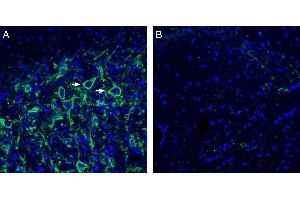 Expression of Neuroligin-3 in rat deep cerebellar nuclei. (Neuroligin 3 antibody  (Extracellular, N-Term))