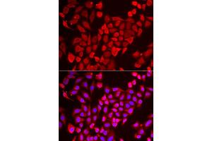 Immunofluorescence analysis of U2OS cell using TNP2 antibody. (TNP2 antibody)