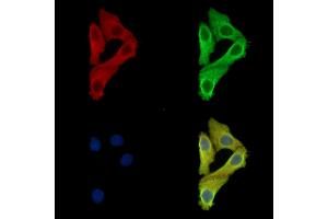 ABIN7097117 and ABIN7101184 staining Hela cells by IF/ICC.