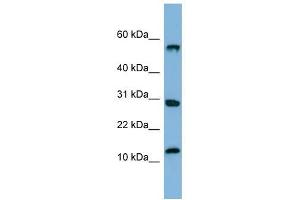 SRP19 antibody used at 1 ug/ml to detect target protein.