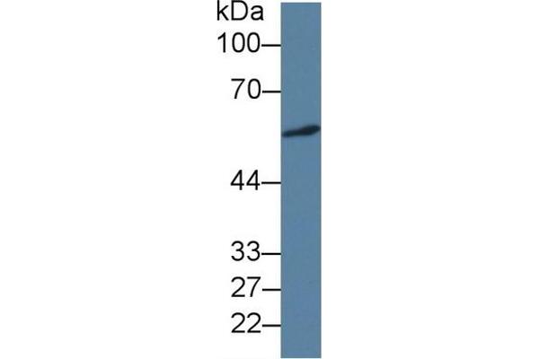 ICA1 anticorps  (AA 1-258)