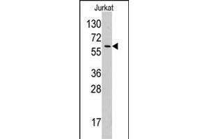 Western blot analysis of YARS polyclonal antibody  in Jurkat cell line lysates (35 ug/lane). (YARS antibody  (N-Term))