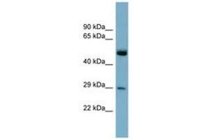 Image no. 1 for anti-RAB27A, Member RAS Oncogene Family (RAB27A) (C-Term) antibody (ABIN6741985) (RAB27A antibody  (C-Term))