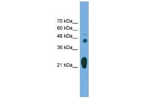 WB Suggested Anti-RAB37 Antibody Titration: 0. (RAB37 antibody  (Middle Region))