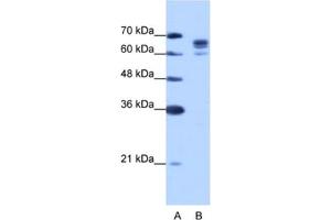 Western Blotting (WB) image for anti-DEAD (Asp-Glu-Ala-Asp) Box Polypeptide 17 (DDX17) antibody (ABIN2462307) (DDX17 antibody)