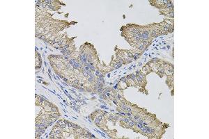 Immunohistochemistry of paraffin-embedded human prostate using IFNG antibody (ABIN5970072) (40x lens). (Interferon gamma antibody)