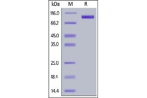 Biotinylated Human ErbB3, His,Avitag on  under reducing (R) condition. (ERBB3 Protein (AA 20-643) (His tag,AVI tag,Biotin))
