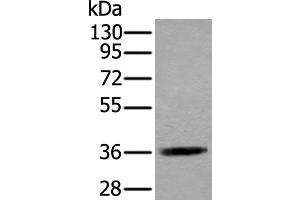 Western blot analysis of Jurkat cell lysate using ACAT2 Polyclonal Antibody at dilution of 1:550