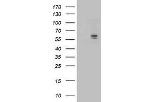 Western Blotting (WB) image for anti-Aldehyde Dehydrogenase 3 Family, Member A2 (ALDH3A2) antibody (ABIN1496594) (ALDH3A2 antibody)