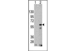 Western Blotting (WB) image for anti-PTEN Induced Putative Kinase 1 (PINK1) antibody (ABIN356392)
