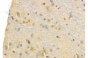 ABIN6258972 and ABIN6275963 at 1/100 staining Rat brain tissue by IHC-P.
