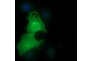Image no. 1 for anti-Epithelial Cell Adhesion Molecule (EPCAM) antibody (ABIN1498119) (EpCAM antibody)