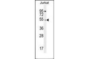 Western blot analysis of DARS1 Antibody (N-term) in Jurkat cell line lysates (35ug/lane). (DARS antibody  (N-Term))