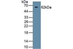Western Blotting (WB) image for Heat Shock 60kDa Protein 1 (Chaperonin) (HSPD1) ELISA Kit (ABIN6574222)