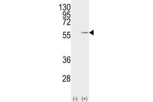 Western blot analysis of Vimentin antibody and 293 cell lysate (2 ug/lane) either nontransfected (Lane 1) or transiently transfected with the VIM gene (2).