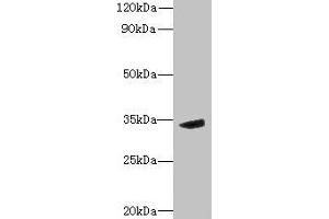 Western blot All lanes: MPPED2 antibody at 6 μg/mL + Mouse brain tissue Secondary Goat polyclonal to rabbit IgG at 1/10000 dilution Predicted band size: 34, 32 kDa Observed band size: 34 kDa (MPPED2 antibody  (AA 1-294))