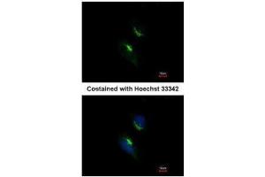 ICC/IF Image Immunofluorescence analysis of methanol-fixed HeLa, using PRPS1, antibody at 1:200 dilution. (PRPS1 antibody)