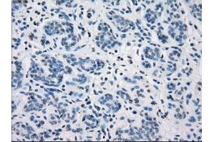 Immunohistochemical staining of paraffin-embedded breast tissue using anti-FCGR2A mouse monoclonal antibody. (FCGR2A antibody)