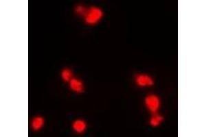 Immunofluorescent analysis of INI1 staining in MCF7 cells. (SMARCB1 antibody)