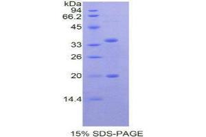 SDS-PAGE (SDS) image for serine Peptidase Inhibitor, Kazal Type 5 (SPINK5) (AA 699-976) protein (His tag) (ABIN1877228) (SPINK5 Protein (AA 699-976) (His tag))