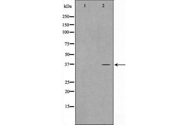CDKL4 antibody  (Internal Region)