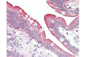Human Small Intestine: Formalin-Fixed, Paraffin-Embedded (FFPE). (Scramblase antibody  (AA 121-170))