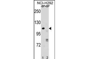 RP1 Antibody (N-term) (ABIN1881627 and ABIN2838811) pre-incubated without(lane 1) and with(lane 2) blocking peptide in NCI- cell line lysate. (PARP1 antibody  (N-Term))