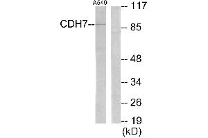 Western blot analysis of extracts from A549 cells, using CDH7 antibody. (Cadherin 7 antibody)