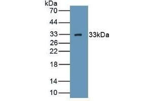 Detection of Recombinant HABP1, Human using Polyclonal Antibody to Complement component 1 Q subcomponent-binding protein, mitochondrial (C1QBP) (C1QBP antibody  (AA 76-282))