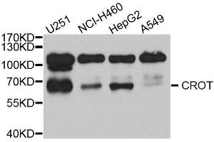 Western Blotting (WB) image for anti-Carnitine O-Octanoyltransferase (CROT) (AA 1-87) antibody (ABIN1679365)