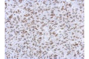 IHC-P Image Immunohistochemical analysis of paraffin-embedded RT2 xenograft, using Lamin A + C, antibody at 1:500 dilution. (Lamin A/C antibody)