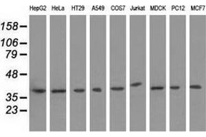 Western blot analysis of extracts (35 µg) from 9 different cell lines by using anti-HIBCH monoclonal antibody. (HIBCH antibody)