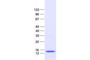 Validation with Western Blot (ANAPC11 Protein (His tag))